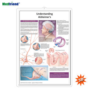 3D Medical Human Anatomical Wall Chart/Poster-Compreendendo a doença de <span class=keywords><strong>Alzheimer</strong></span> Anatomical Chart - Product Image 1