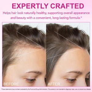 Suplemento Vitamínico SOLOTREE 5000 Mcg con Biotina, Aceite de Argán, Ácido Hialurónico, Colágeno y <span class=keywords><strong>Complejo</strong></span> de Queratina para la Salud del Cabello, la Piel y las Uñas - Product Image 4