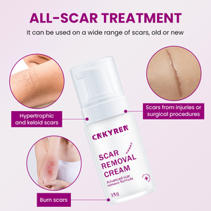 <span class=keywords><strong>ครีม</strong></span>บำรุงผิวหน้าต่อต้านริ้วรอยด้วยกรดไฮยาลูโรนิก เชียบัตเตอร์ และกรดแลคโตไบโอนิก สำหรับ<span class=keywords><strong>ลด</strong></span><span class=keywords><strong>รอย</strong></span>แผลเป็นจาก<span class=keywords><strong>สิว</strong></span>และ<span class=keywords><strong>รอย</strong></span>แตกลาย - Product Image 3