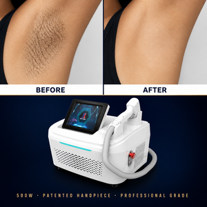 Épilateur Laser Portable Diodi 4 en 1, Machine d'Épilation Laser Diodo pour le Visage et le Corps - Product Image 1