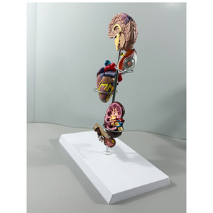 Modelos Anatómicos Médicos de Patología de la Presión Arterial Alta de Maxcare (Cerebro/Ojos/Corazón/Riñones/Vasos Sanguíneos/Organos Internos) de PVC - Product Image 3