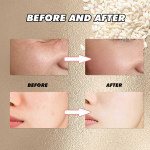 <span class=keywords><strong>Crema</strong></span> Viso Calantha Biologica Vegana al Collagene, <span class=keywords><strong>Acido</strong></span> <span class=keywords><strong>Ialuronico</strong></span> e Riso, <span class=keywords><strong>con</strong></span> Vitamina E, Idratante, Antirughe, Sbiancante e Rassodante, 50g - Product Image 4