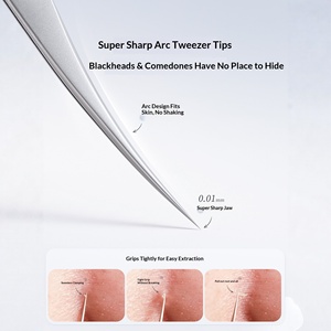 Ensemble de pinces à épiler professionnelles en acier inoxydable pour éliminer les points noirs, extracteur d'acné de précision, élimination des comédons pour le nettoyage des pores du visage - Product Image 2
