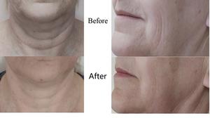 Au-8403 diskon besar-besaran harga pabrik sarung tangan BIO Galvanic mesin Kecantikan Toning wajah arus mikro - Product Image 6