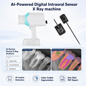 Équipement de <span class=keywords><strong>radiographie</strong></span> <span class=keywords><strong>dentaire</strong></span> avec capteur intra-oral alimenté par l'IA pour l'imagerie numérique destinée aux cliniques d'endodontie - Product Image 2