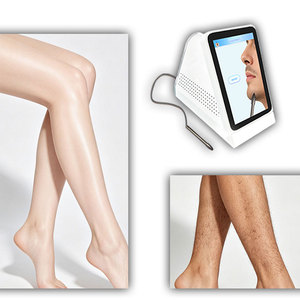 Épilateur à électrolyse à <span class=keywords><strong>prix</strong></span> avantageux, en matériau ABS, avec approbation médicale CE, pour salon - Product Image 1