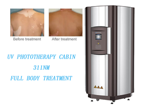 Máquina de fototerapia UV de cuerpo completo con luz UVB de 311nm, modelo KN-4001, para el tratamiento del vitíligo y la psoriasis. - Product Image 2