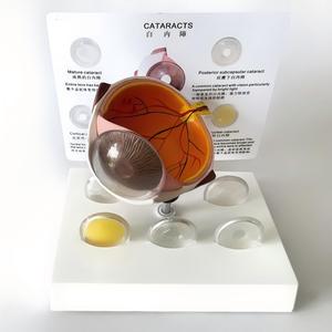 Modelo Anatómico Ampliado del Ojo Humano con 5 <span class=keywords><strong>Tipos</strong></span> <span class=keywords><strong>de</strong></span> Lentes <span class=keywords><strong>de</strong></span> Catarata para <span class=keywords><strong>la</strong></span> Enseñanza <span class=keywords><strong>de</strong></span> Oftalmología - Product Image 4