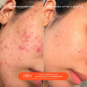 El aerosol facial de ácido hipocloroso de rescate diario SOS de etiqueta privada para pieles sensibles ayuda a reducir el enrojecimiento por brotes de irritación - Product Image 4