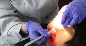 Laser Diode Dentaire Fibre Optique pour Blanchiment des Dents, Biostimulation, Physiothérapie et Traitement des Tissus Mous Dentaires - Product Image 3