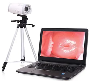 Digital Colposcope Device HD Video Vaginal Colposcope Camera For Gynecology