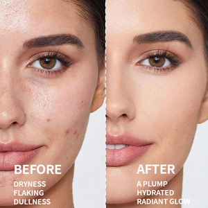 Nettoyant Moussant au <span class=keywords><strong>Lait</strong></span> d'Acides Aminés Démaquillant Faible pH Hydratant Éclaircissant pour Peaux Sensibles OEM - Product Image 4