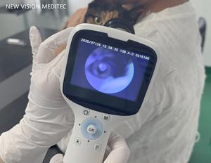 Caméra professionnelle Fundus pour animaux de compagnie Caméra rétinienne <span class=keywords><strong>portable</strong></span> non mydriatique pour vétérinaire - Product Image 2