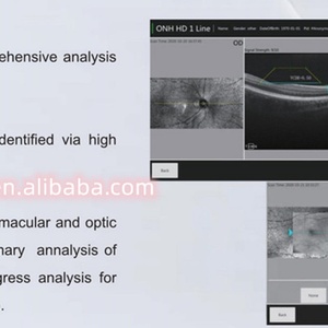OCT-50 New Product Optical Coherence Tomography, Ophthalmic OCT Scanner Sensor - Product Image 6
