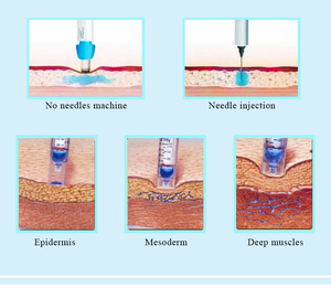Lápiz de Inyección sin Agujas para Mesoterapia, Rejuvenecimiento de la Piel, Blanqueamiento, Antiarrugas, Inyector de Ácido Hialurónico sin Dolor, Dispositivo de Belleza - Product Image 6