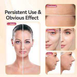 Outils de <span class=keywords><strong>ventouse</strong></span> faciale électriques SHOmfrs, ventouses pour le <span class=keywords><strong>visage</strong></span>, massage pour les yeux, le cou, beige clair, soin, 3 tailles de ventouses à aspiration, ODM - Product Image 5