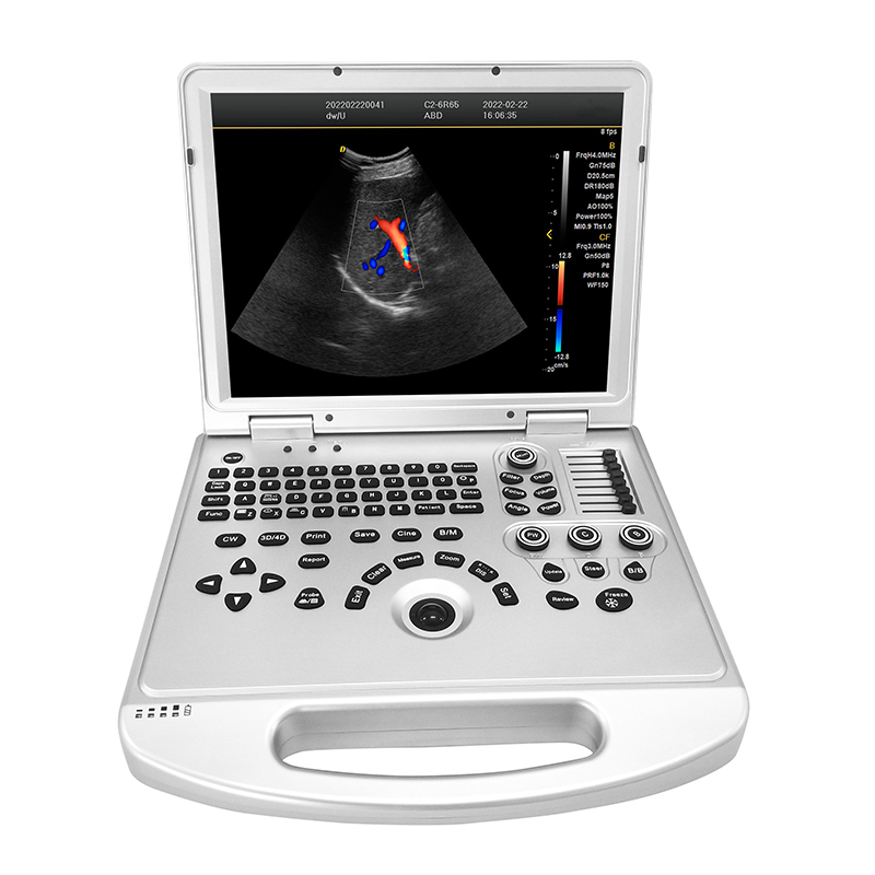 MN-UltraL3 3D probe Portable  Cardiac Obstetric Ultrasound color Doppler Ultrasound
