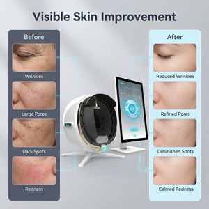 2026 AI Skin Analysis 3D Face Skin Analyzer Salon <strong>Home</strong> Use UV Facial <strong>Tester</strong> with Scalp Detection - Product Image 2