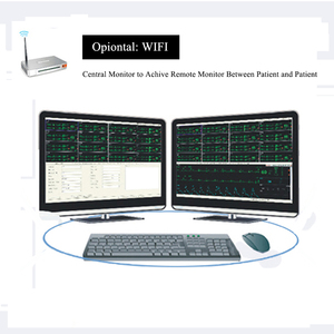 15 inch màn hình cảm ứng Vital Signs <span class=keywords><strong>Monitor</strong></span> đa thông số giám sát trung tâm Treo Tường Xe đẩy bệnh nhân <span class=keywords><strong>Monitor</strong></span> - Product Image 4
