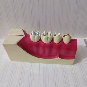 โมเดลฟัน Dt Dental รุ่น Mx-2 แบบถอดประกอบได้ พร้อมแม่เหล็ก สำหรับการเรียนการสอน ขนาด 11*4*5.3 ซม. สำหรับทำความสะอาดและอุดฟัน อุปกรณ์ทันตกรรม - Product Image 1