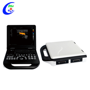 Fournisseur à guichet unique Sonoscape 3D Instruments à ultrasons médicaux Trolley Machine à ultrasons Doppler couleur - Product Image 4