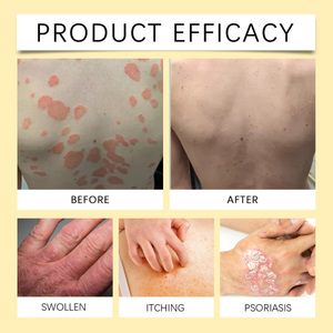 OCEAURA 허브 건선 케어 진정 및 보습 피부 상쾌한 비누 - Product Image 2