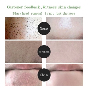 Label privé meilleur gel biologique blanchissant visage élimination de l'acné nettoyant de pores infusé de thé au curcuma <span class=keywords><strong>masque</strong></span> dissolvant de points noirs <span class=keywords><strong>Peel</strong></span>-<span class=keywords><strong>Off</strong></span> - Product Image 4