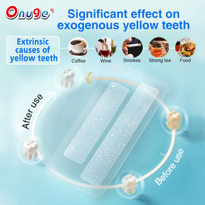 <span class=keywords><strong>Onuge</strong></span> 14 Beste Oplosbare Premium Gearomatiseerde Tandheelkundige Natuurlijke Witmakende Tandstrips Zonder Peroxide - Product Image 3