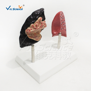 Modelo <span class=keywords><strong>de</strong></span> Comparación <span class=keywords><strong>de</strong></span> Pulmón Saludable <span class=keywords><strong>y</strong></span> Pulmón <span class=keywords><strong>de</strong></span> <span class=keywords><strong>Fumador</strong></span>, Modelo <span class=keywords><strong>de</strong></span> Contraste Patológico Pulmonar para la Popularización <span class=keywords><strong>de</strong></span> la Salud Respiratoria - Product Image 3