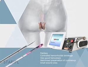 Traitement des hémorroïdes Fistule anale 1470nm Chirurgie des hémorroïdes externes 980nm Rectum Fissure Proclotology Thérapie de traitement - Product Image 3