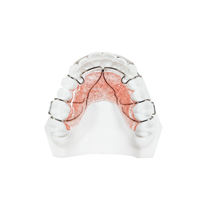 Plaque d'expansion orthodontique dentaire amovible en acrylique avec vis d'expansion - Product Image 5