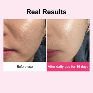 Crème au collagène et peptides <span class=keywords><strong>Lance</strong></span> Private Label, renforce la fermeté, améliore l'élasticité de la peau, lisse la texture de la peau - Product Image 6