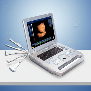 Appareil d'échographie Doppler 3D Sun-800D, ordinateur portable 15 pouces, appareil d'échographie obstétrique et gynécologique pour la grossesse, appareil portable - Product Image 1
