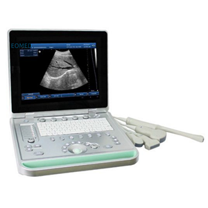 Ordinateur portable cardiaque portable Machine à ultrasons <span class=keywords><strong>Prix</strong></span> échocardiographie médicale USG <span class=keywords><strong>Echo</strong></span> Machine vétérinaire BW09 - Product Image 2