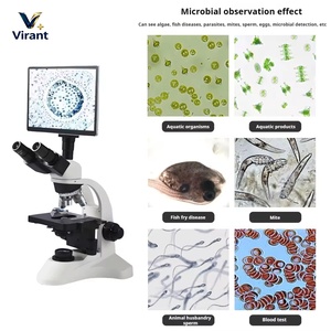 <span class=keywords><strong>Microscopio</strong></span> Digital Trinocular Veterinario con Pantalla HD y Múltiples Lentes para Examen de Muestras de <span class=keywords><strong>Sangre</strong></span>, Esperma y Tejido Animal - Product Image 5