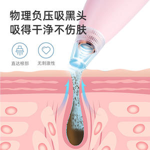 Limpiador de Poros Eléctrico Inalámbrico, Extractor de Puntos Negros Portátil, Limpiador Nasal con Recarga USB para Uso Doméstico - Product Image 5