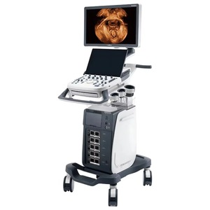 Ultrassom Colorido de Alta Frequência Sonoscape P20 Elite Tipo Carrinho para Exame Pré-Natal e Exclusão de Malformações Fetais - Product Image 1