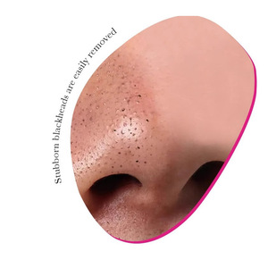 แผ่นมาส์กกำจัดสิวเสี้ยนและสิวอุดตัน ROSOTENA สำหรับใบหน้าและจมูก 10 ชิ้น อายุการเก็บรักษา 3 ปี - Product Image 4