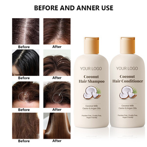 Shampooing et après-shampooing <span class=keywords><strong>bio</strong></span> à l'huile de <span class=keywords><strong>coco</strong></span> et à la biotine de votre propre marque (OEM) – Kit de soins capillaires pour le contrôle du sébum et l'élimination des pellicules - Product Image 3