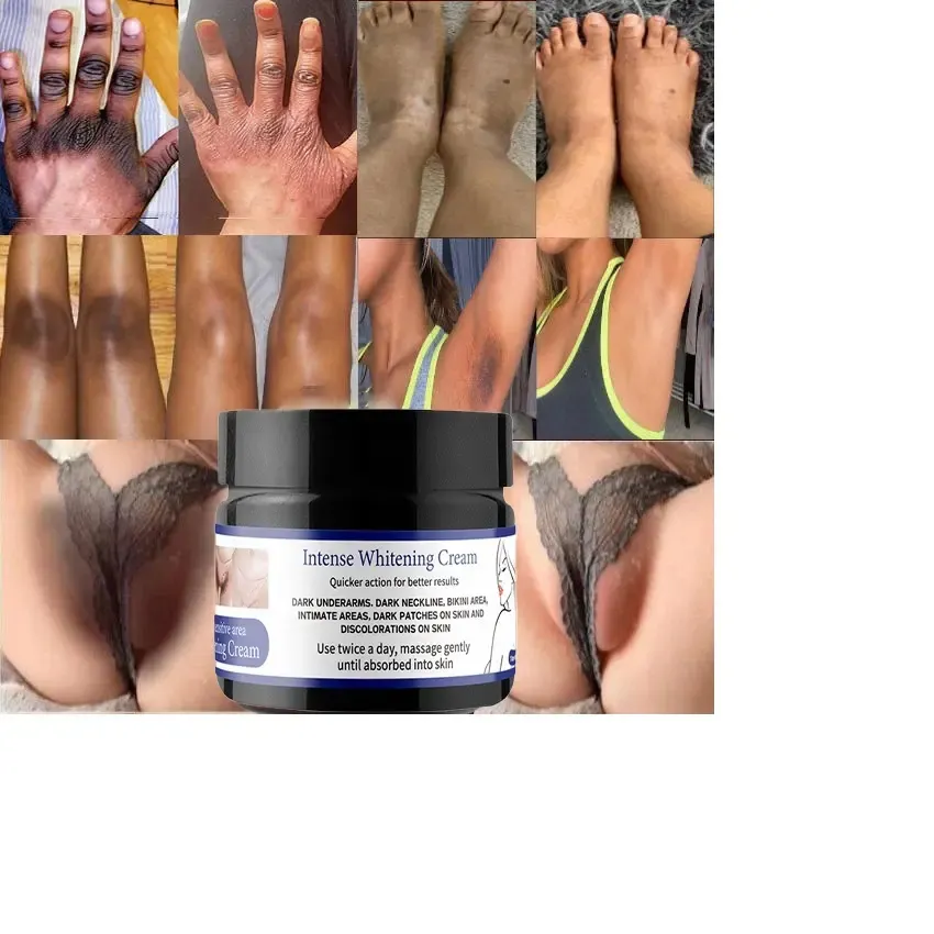 Body Whitening Cream Onderarmbenen Knie Elleboog Private Delen Fleuren Oksel Bleekcrème Verwijderen Donkere Vlekken Melanine Huidverzorging