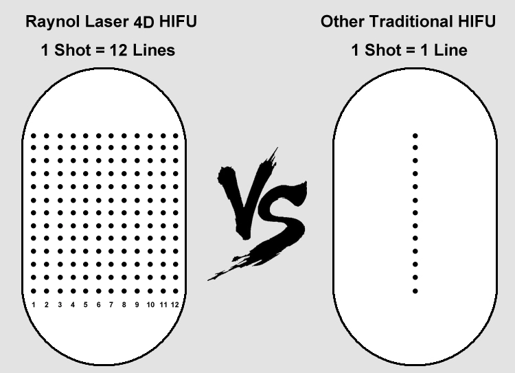 12 líneas 4D ultra hacen frente al cuerpo de elevación que adelgaza el ajuste de la piel del ultrasonido de la máquina