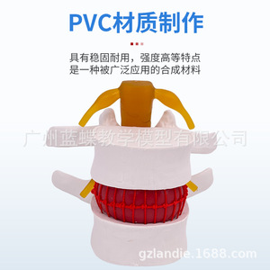 Simulation pédagogique du modèle de hernie discale lombaire humaine, démonstration de mesure de la pression vertébrale, vertébral - Product Image 2