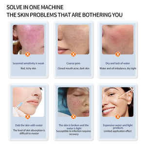 Máquina Portátil de Cuidado Facial Profesional Hello Face3 con Pantalla Táctil, Chorro de Oxígeno de Alta Frecuencia, Limpieza Profunda con Gas-Líquido - Product Image 2