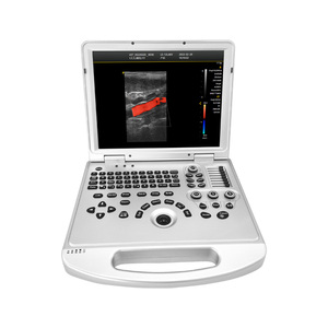 Escáner <span class=keywords><strong>de</strong></span> Ultrasonido Veterinario Digital L3-VET en Oferta, Doppler <span class=keywords><strong>de</strong></span> Energía Direccional que Muestra la Dirección del Flujo Sanguíneo para <span class=keywords><strong>Todo</strong></span> <span class=keywords><strong>Tipo</strong></span> <span class=keywords><strong>de</strong></span> Animales - Product Image 3