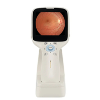 Cámara de Fondo de Ojo Portátil HFC-1, Instrumento Oftálmico Digital de Alta Definición para Uso Veterinario y Humano