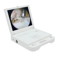 Système de caméra d'endoscopie médicale 17 pouces 1080p HD avec source de lumière LED portable, caméra d'endoscopie médicale tout-en-un