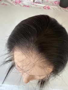 <span class=keywords><strong>Parrucche</strong></span> in Capelli Umani Lisci con Pizzo Integrale Full HD, Densità 150%, Traspiranti e Senza Colla - Product Image 4