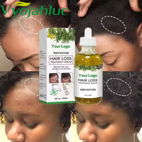 Huile de croissance capillaire au romarin 60 ml, marque privée, vente en gros, pour tous types de cheveux