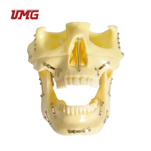 Modèle de <span class=keywords><strong>crâne</strong></span> pour la pratique des implants de fixation de fractures avec plaque en titane prépositionnée pour la formation chirurgicale, l'enseignement et la démonstration - Product Image 3