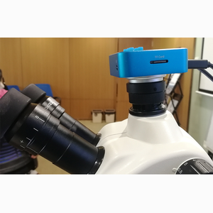 Professional Dental Operating <strong>Microscope</strong> for Surgical Visualization with Ergonomic Design Clinical Treatment <strong>Microscope</strong> - Product Image 6